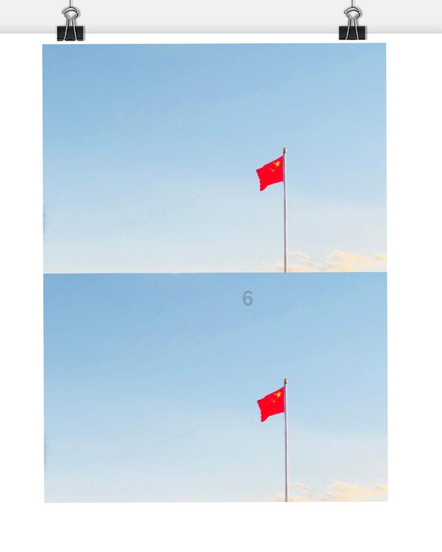 患有帕金森病的人应该注意哪些事项来保护颈椎健康呢?